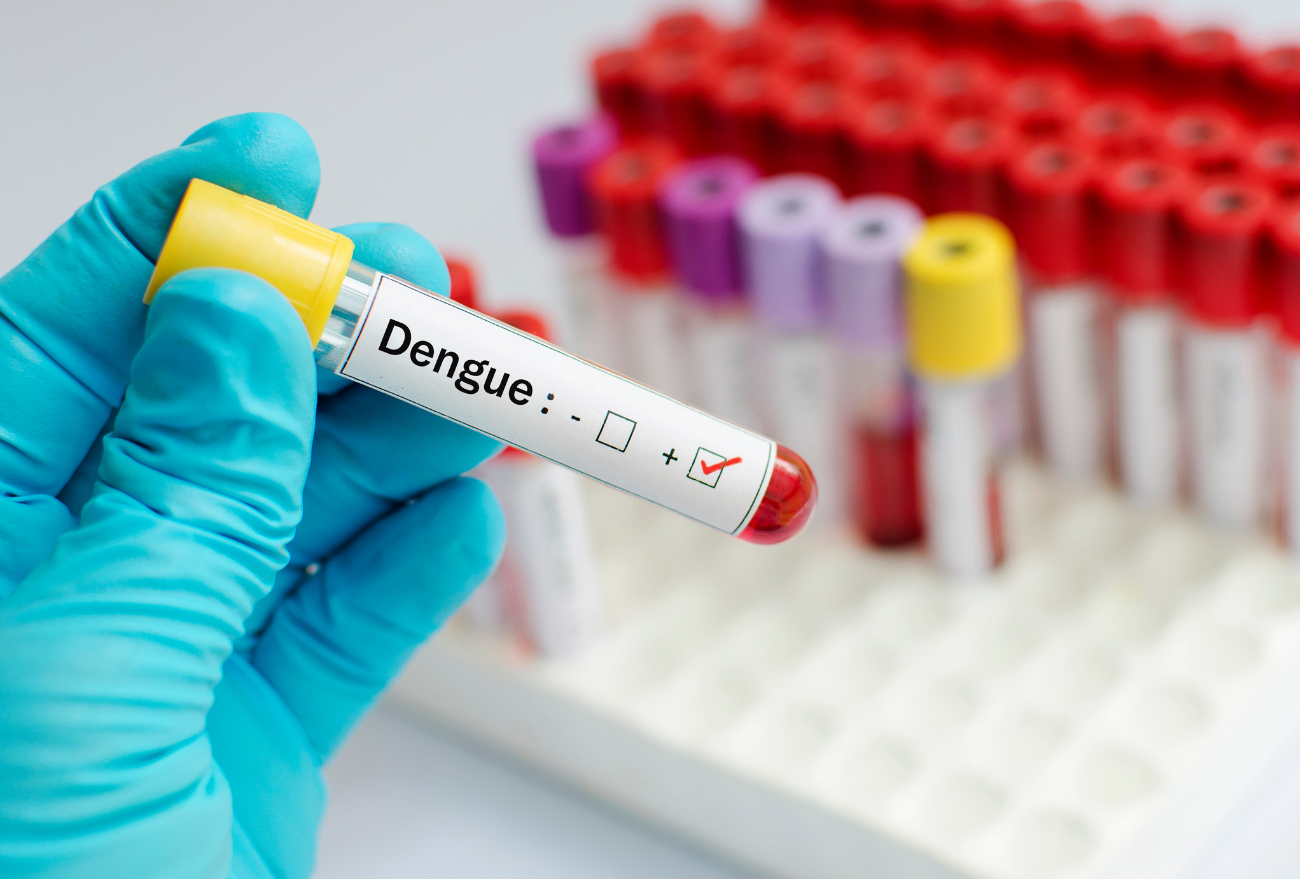 Faxinal dos Guedes conta com 23 casos positivos de Dengue